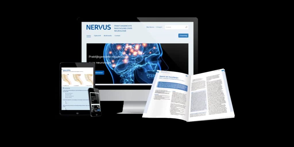 Nervus op verschillende apparaten